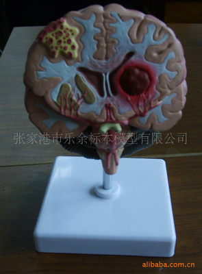 精准教学，赋能未来——高端脑中风病理模型助力医学教育革新